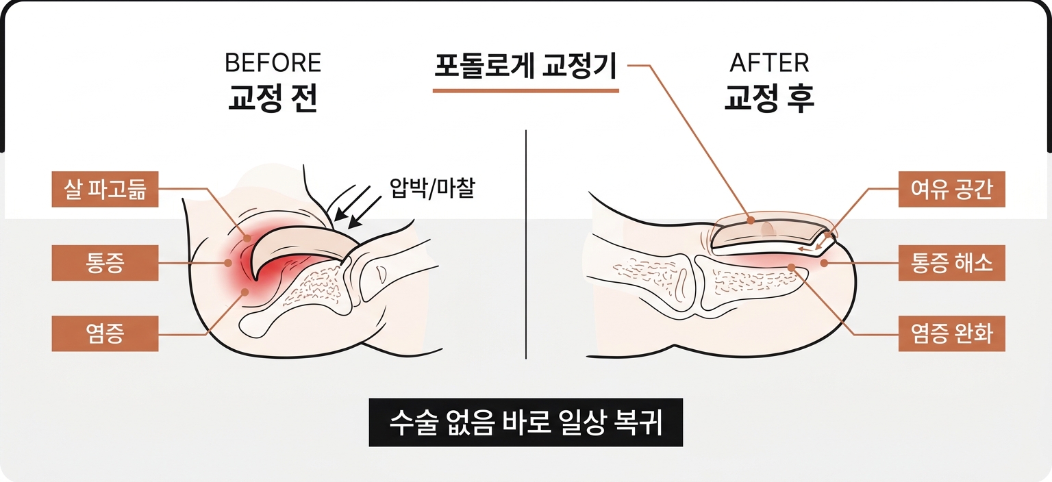 포돌로게 Before/After